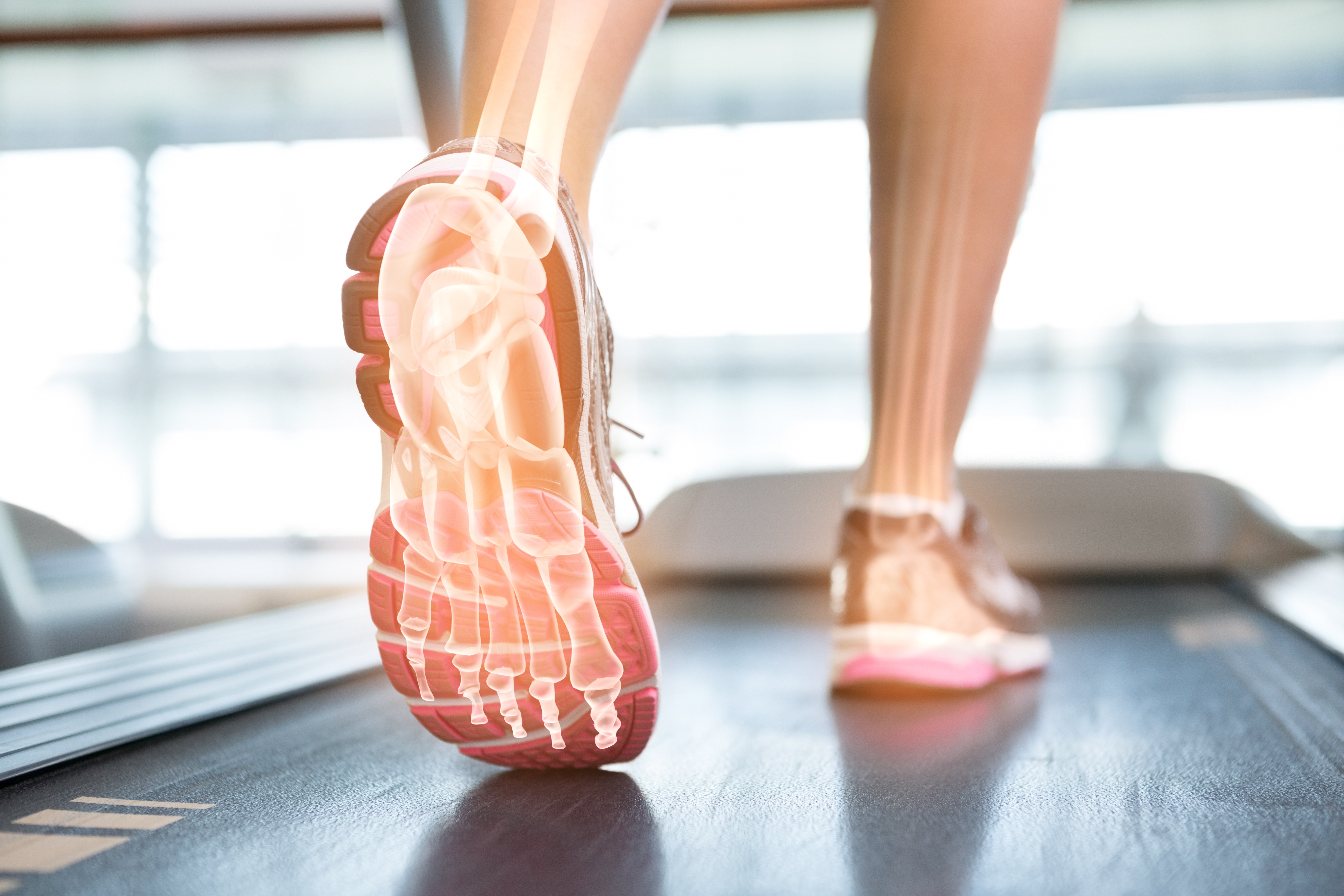 Plantar Fasciitis - A Pain in the Foot